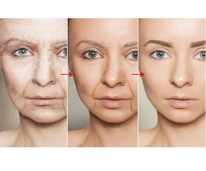 Retinol Wrinkle Remover Face Cream