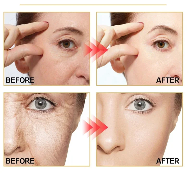 Retinol Wrinkle Remover Face Cream