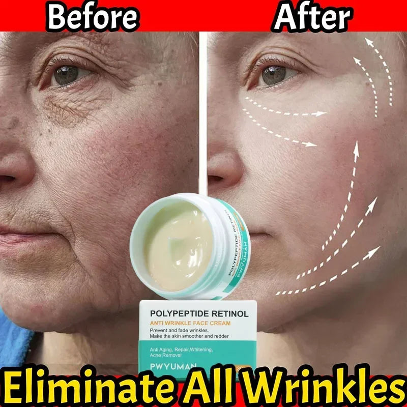 Retinol Wrinkle Remover Face Cream