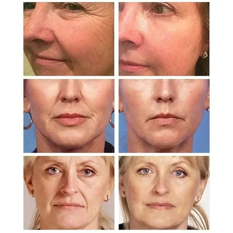 Retinol Wrinkle Remover Face Cream