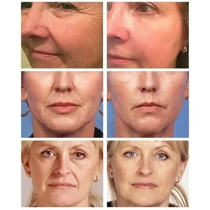 Retinol Wrinkle Remover Face Cream