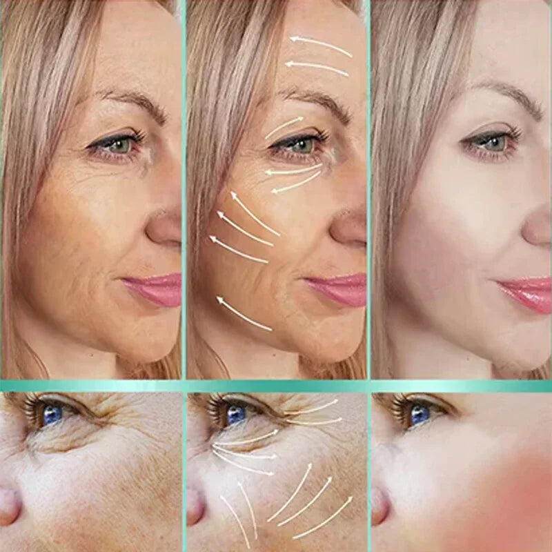 Retinol Wrinkle Remover Face Cream