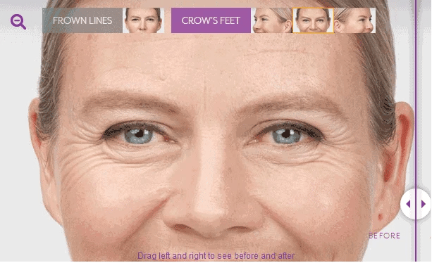 Retinol Wrinkle Remover Face Cream