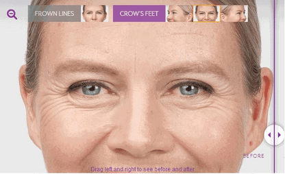 Retinol Wrinkle Remover Face Cream